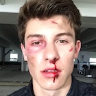 Shawn Mendes : shawn-mendes-1435448521.jpg